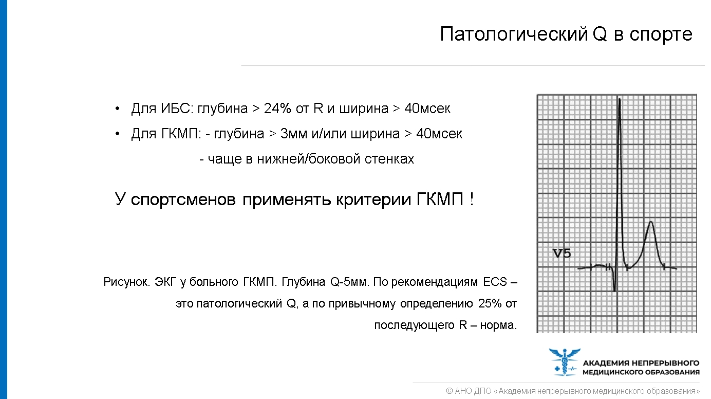 Мы все знаем, что регулярная физическая активность необходима для поддержания здоровья и общего благополучия. Но какой вид спорта следует выбрать, чтобы максимально эффективно улучшить работу нашего главного органа – сердца? На сегодняшний день, имеется множество возможностей, и каждый спорт может принести свои особенные преимущества.