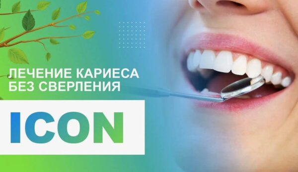 ICON детям: как вылечить начальный кариес без бормашины и боли